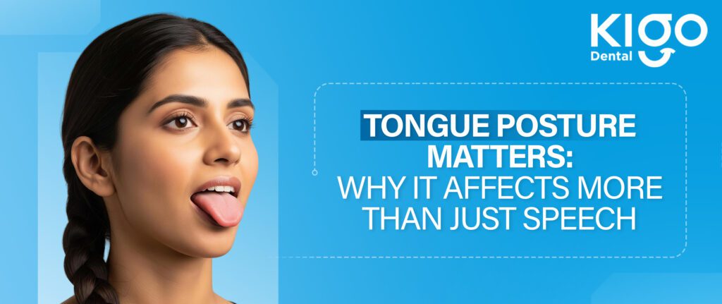 Tongue posture