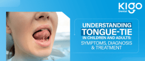 Tongue-tie treatment in Hyderabad