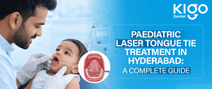Laser Tongue Tie Treatment in Hyderabad