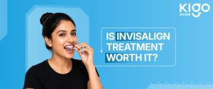 is invisalign treatment worth it