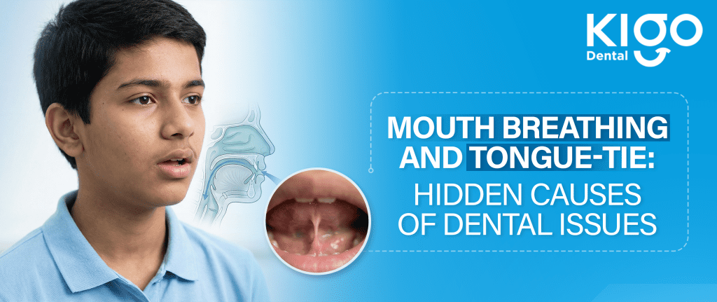 Mouth Breathing Treatment In Hyderabad