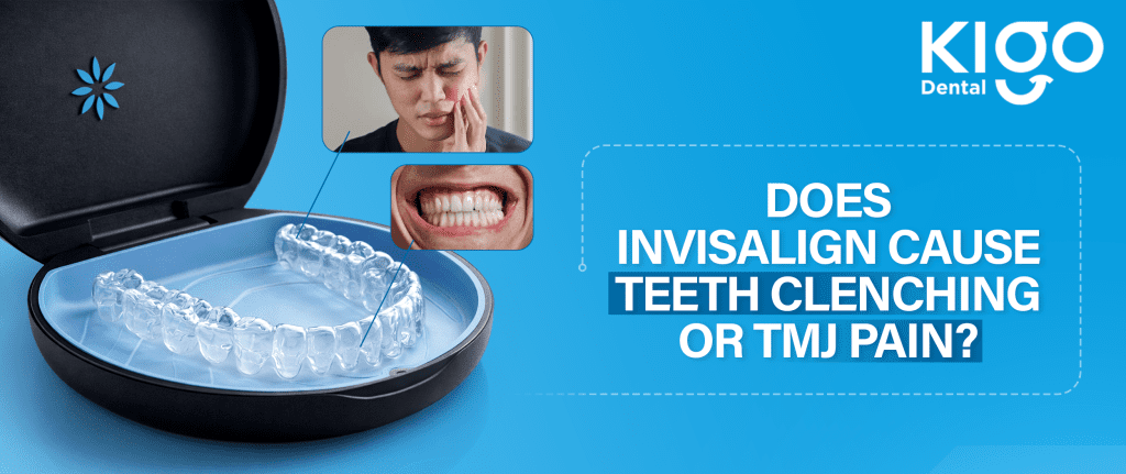Invisalign treatment in Hyderabad