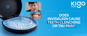 Invisalign treatment in Hyderabad