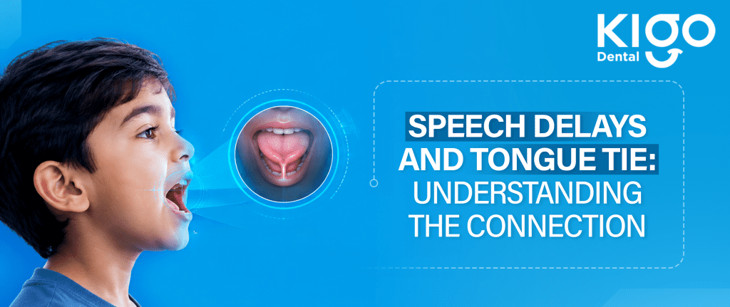 tongue tie treatment in hyderabad