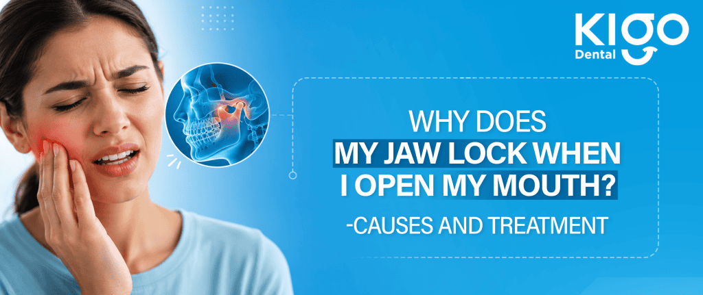 jaw locking treatment Hyderabad