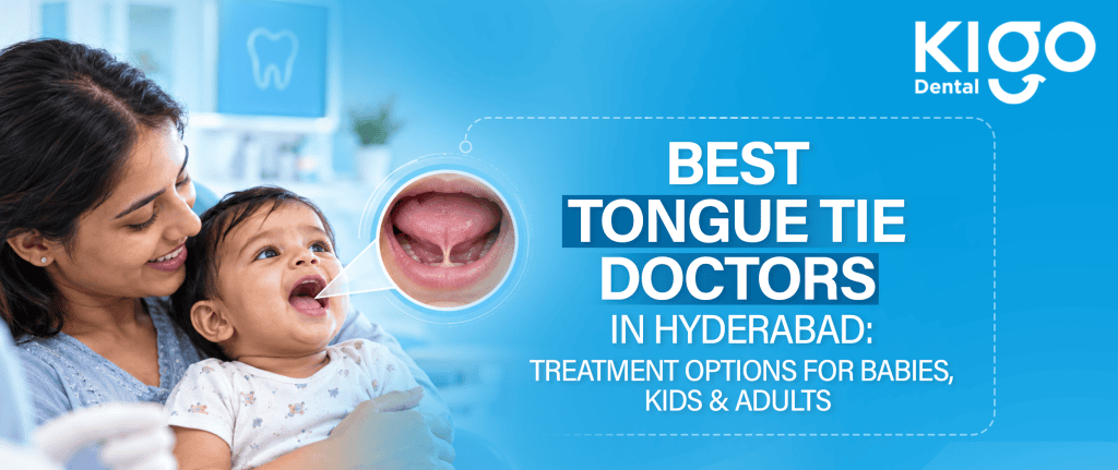 Tongue Tie Doctors in Hyderabad