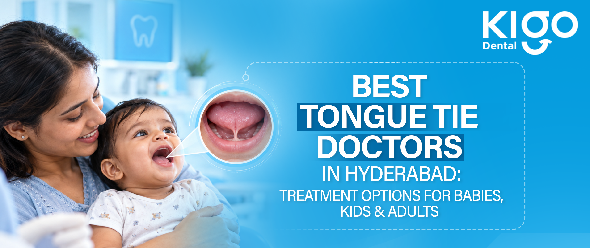 Tongue Tie Doctors in Hyderabad