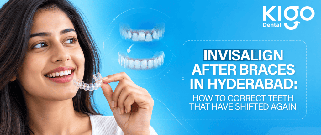 Invisalign After Braces in Hyderabad