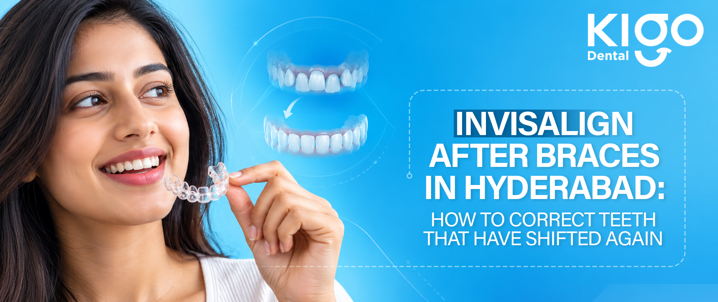Invisalign After Braces in Hyderabad